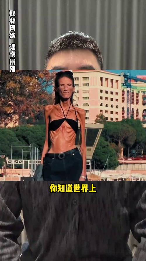 英国女子减重114斤后为何变成了人生噩梦？