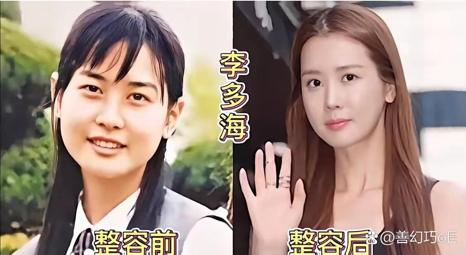 韩星减肥后真的会变成俊男靓女吗？