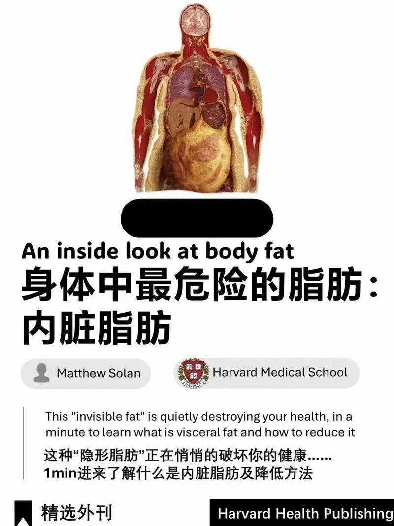 内脏脂肪对健康危害真的那么大吗？肥胖人士该如何谨慎应对？