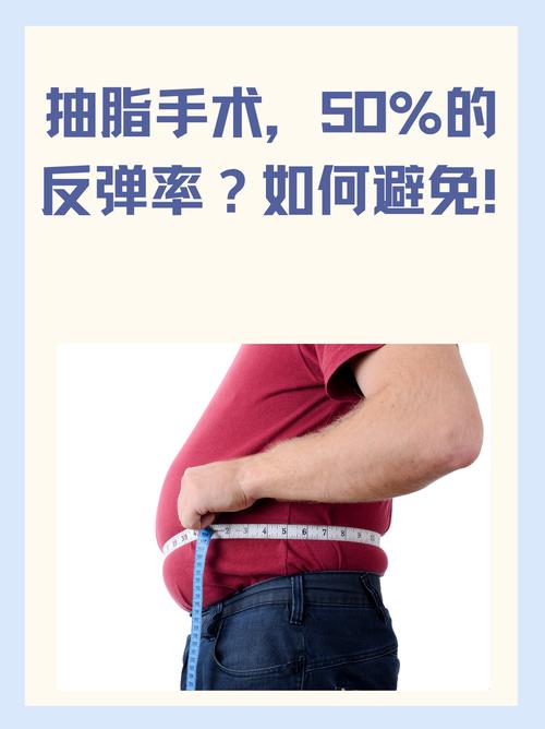大腹便便的男人是不是最该考虑抽脂呢？