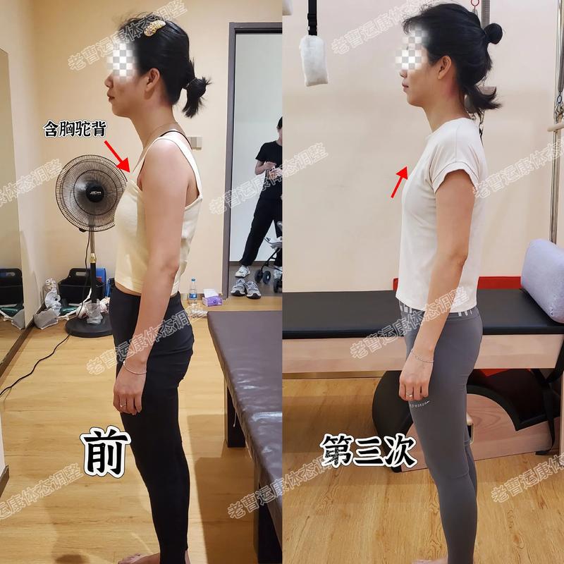 一个不经意的含胸驼背，难道不会引发意想不到的严重后果吗？