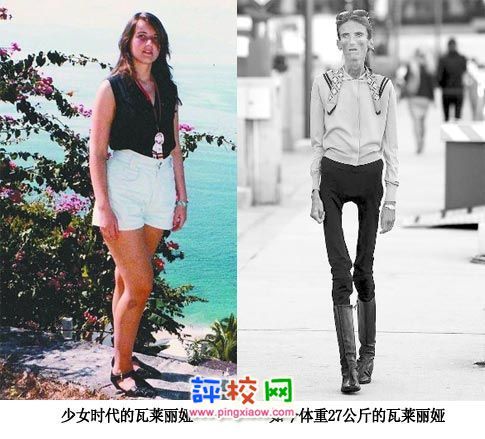 厌食症折磨少女5年，跑步竟成拯救她的关键？