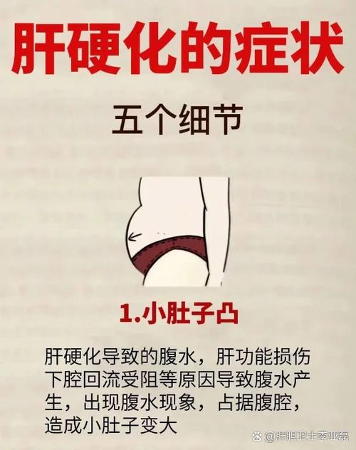 年轻人，你警惕过自己的肝脏会音位发胖而受损吗？