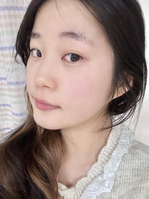 日本蕞美丽脸蛋如今满脸颗粒，是节食减肥导致的吗？