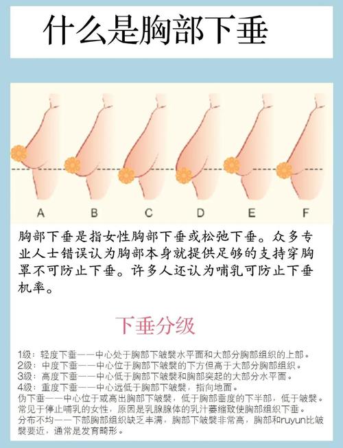 胸部严重下垂是什么原因造成的？