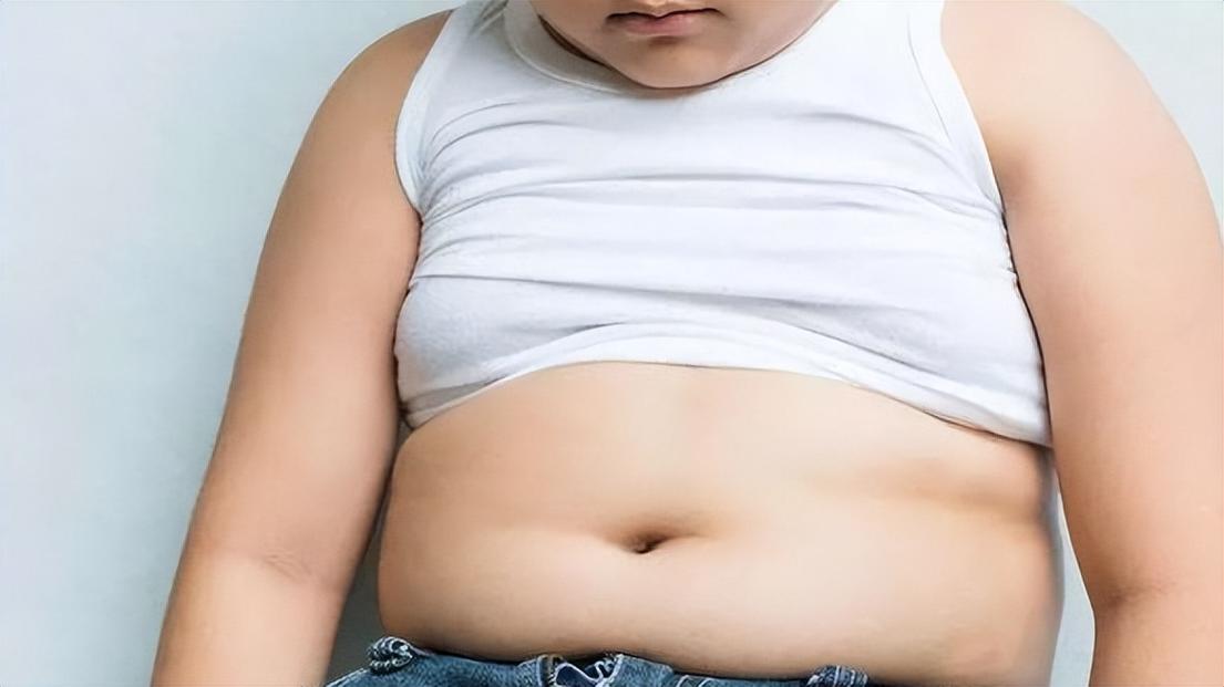 儿童肥胖有哪些具体特点或表现？