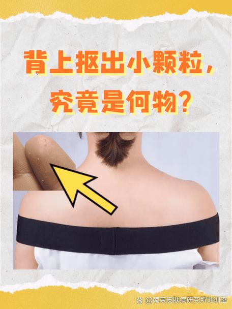 这个物体的背部为何如此流线型？