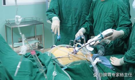 通过遥控胃束带手术减重58公斤的英肥婆手术方法是什么？