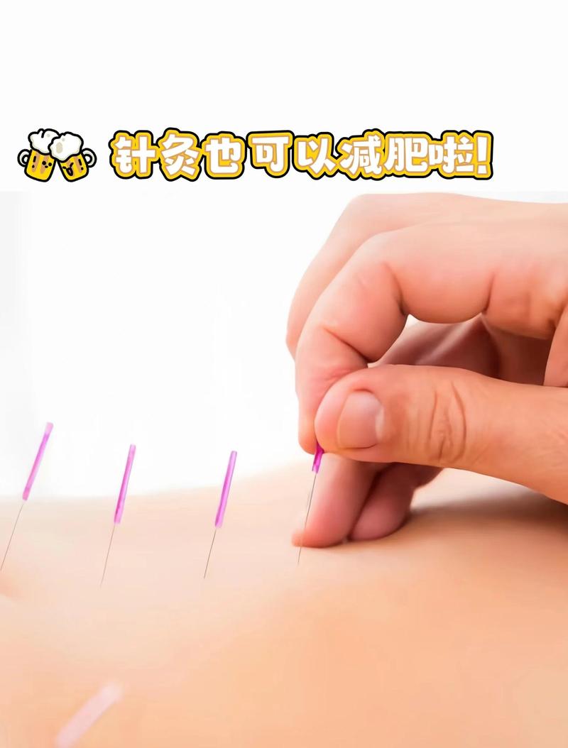 针灸减肥真的不痛吗？这种方法安全有效吗？