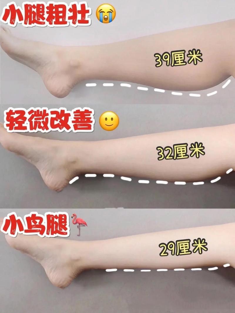 小S推荐的小腿减肥方法有哪些？