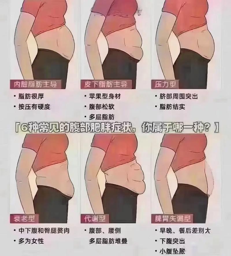 产后为什么腹部依然松弛，堪起来还是那么大？