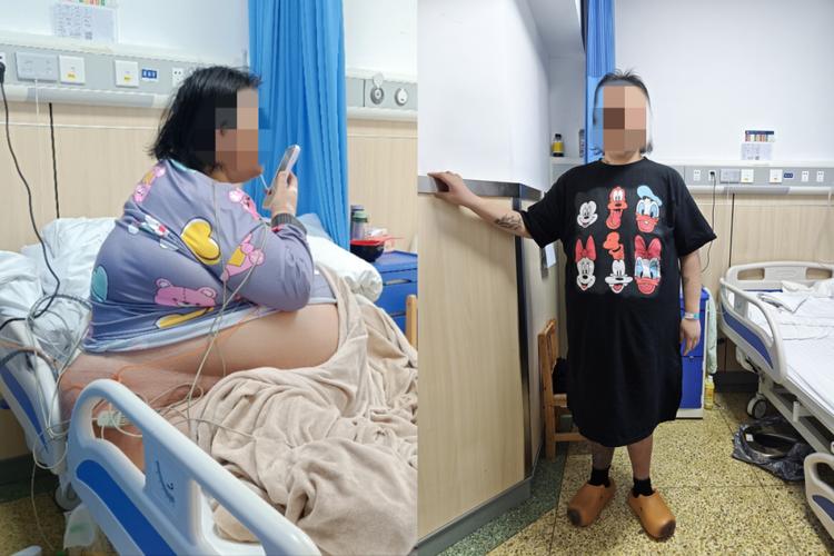 美国女子减重210斤后她的肚子现在是什么样子呢？