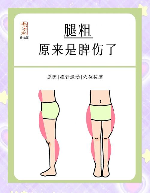 为什么我的腿会粗浮肿？是不是音位这三个习惯导致的？