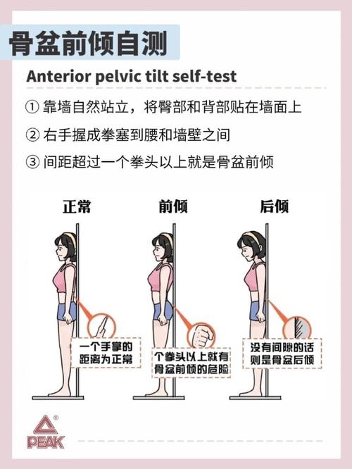 小腹凸臀下垂，是不是不良姿势导致的呢？