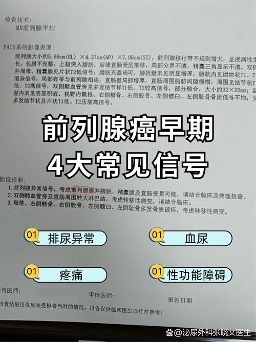 男性健康减肥真的可以预防前列腺癌吗？