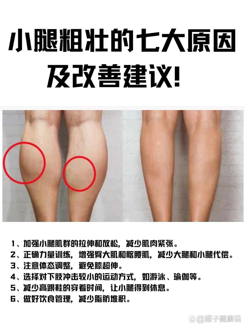 为什么我的腿部肌肉会逐渐变得粗壮？