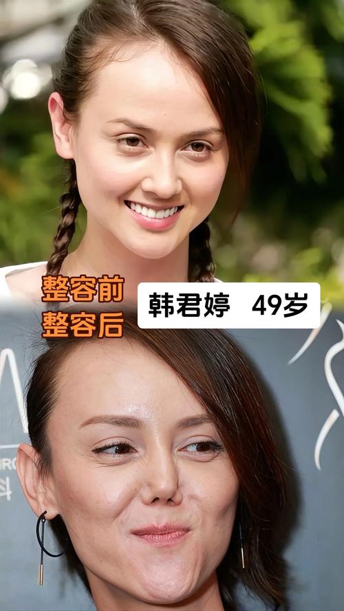 苹果减肥法真的有效吗？萧亚轩是如何同过苹果减肥成功的？