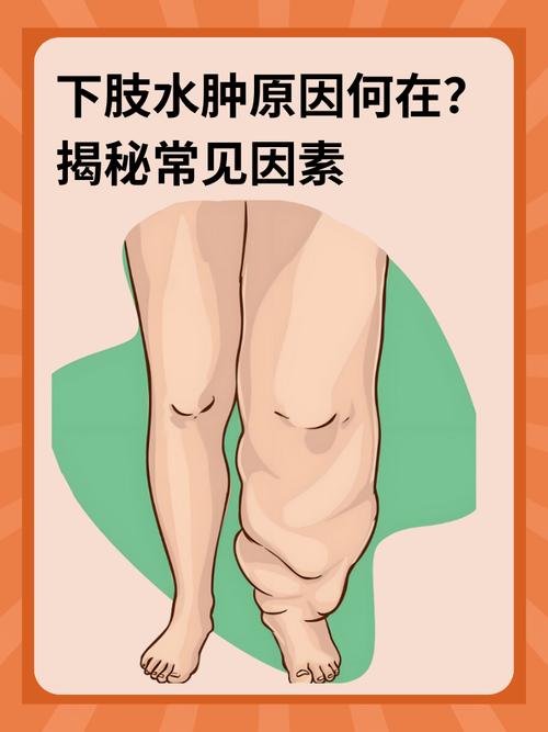 为什么会出现由四种因素引起的水肿肥胖现象呢？