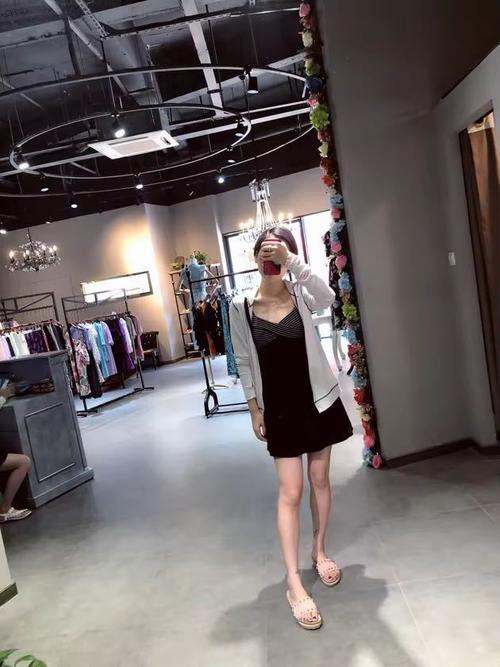 抽脂手术的真实体验是怎样的？术后效果和恢复过程如何？