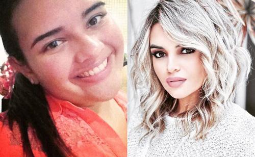 巴西姑娘减掉165斤肥肉后嫩变成性感女神吗？