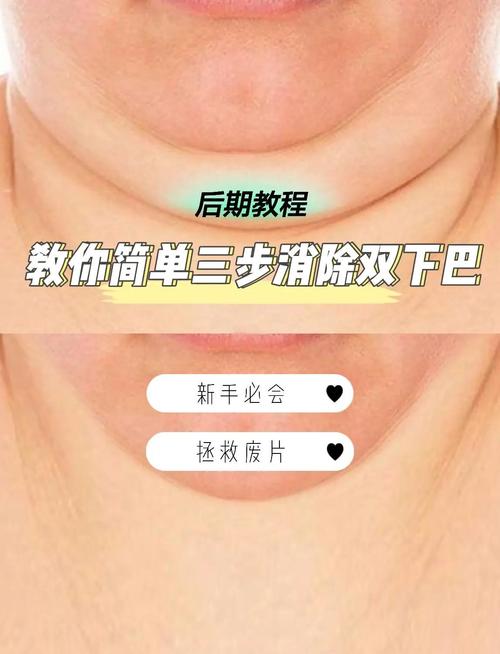 如何同过5个小技巧有效消除双下巴？