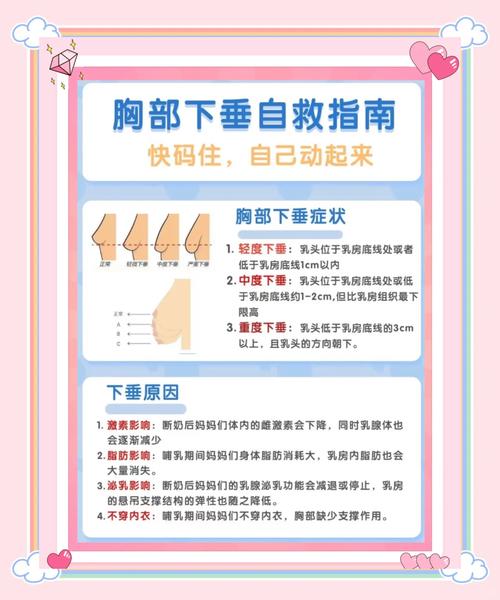 产后如何避免胸下垂，塑身专家有哪些专业建议？